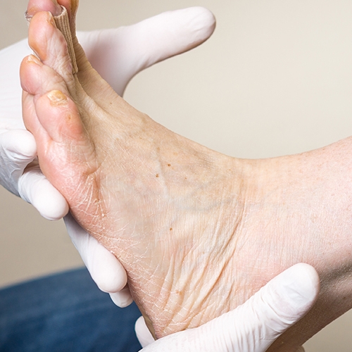 physical-therapy-clinic-orthotics-albatross-physical-therapy-and-wellness-wheaton-il